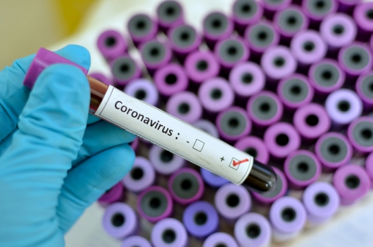 How to Prepare for Coronavirus??